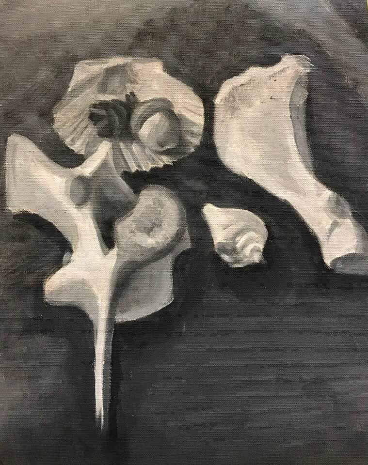 Dry Bones